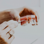 zubni implantat